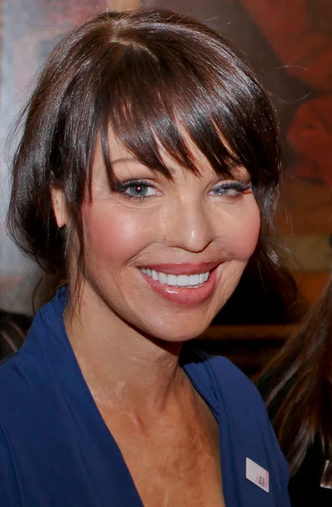 Katie Piper